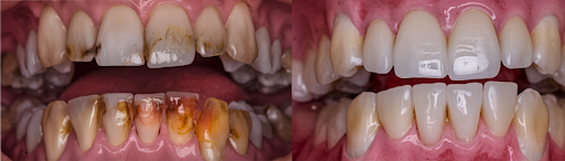 Comparison